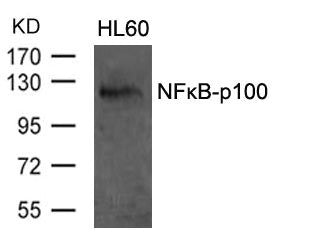 NFKB2 (Ab-870) Antibody