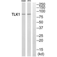 TLK1 Antibody