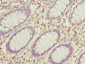 HDAC1 Antibody