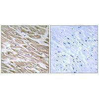 KANK2 Antibody