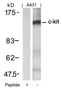 FGFR1 (Ab-721) Antibody