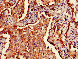 HLA-DRB1 Antibody, Biotin conjugated