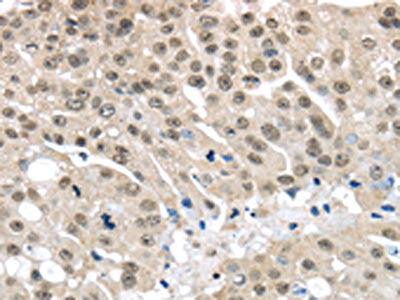 MED15 Antibody