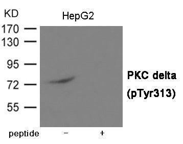 Phospho-PRKCD (Tyr313) Antibody