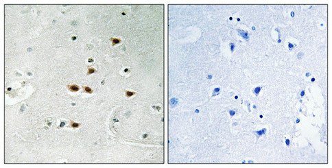 Phospho-ITCH (Tyr420) Antibody