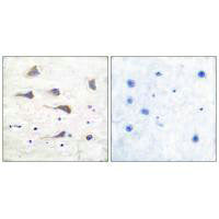 GRM6 Antibody