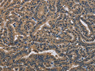 DNAJA1 Antibody