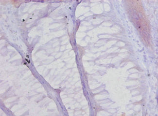 COL17A1 Antibody