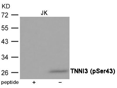 Phospho-TNNI3 (Ser43) Antibody