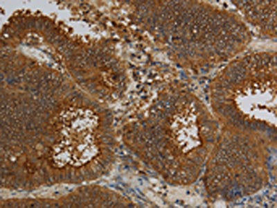 KCNK17 Antibody