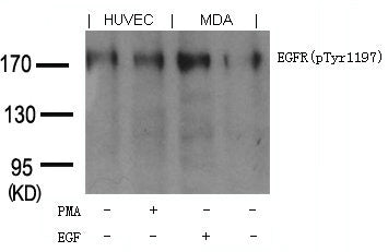 Phospho-EGFR (Tyr1197) Antibody