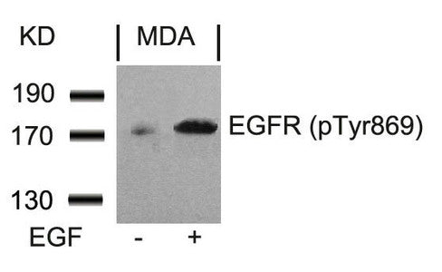 Phospho-EGFR (Tyr869) Antibody