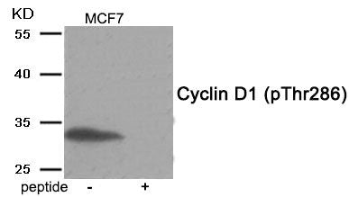 Phospho-CCND1 (Thr286) Antibody