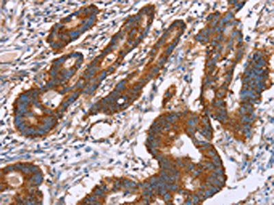 PDLIM1 Antibody