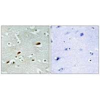 KAT5 Antibody