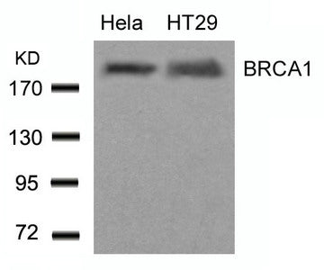 BRCA1 (Ab-1423) Antibody