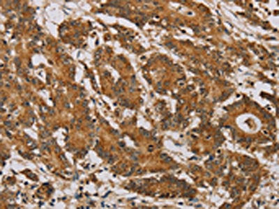 NDUFA10 Antibody