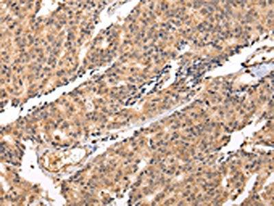SWAP70 Antibody