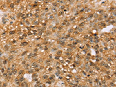 MED22 Antibody