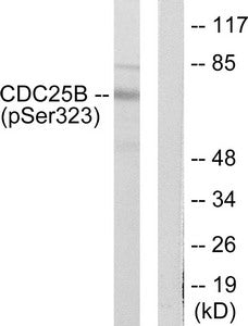 Phospho-CDC25B (Ser323) Antibody