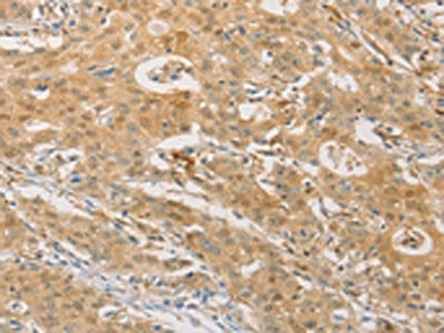 PGK2 Antibody