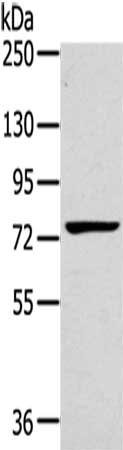 RHOBTB1 Antibody