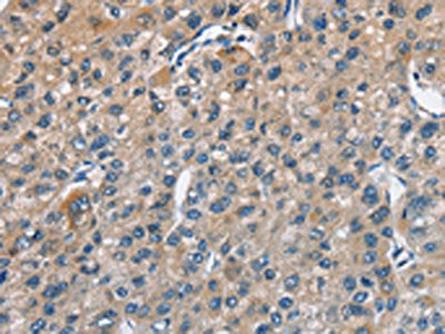 TRIP4 Antibody