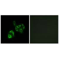 SLC27A4 Antibody