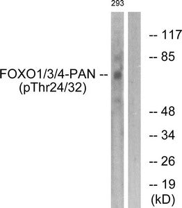 Phospho-FOXO1/FOXO3/FOXO4 (Thr24/32) Antibody