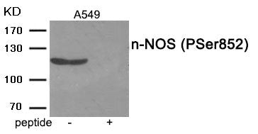 Phospho-NOS1 (Ser852) Antibody