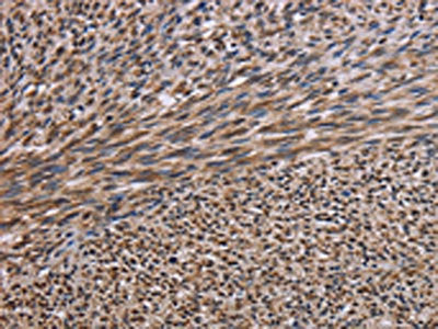 KIF2A Antibody