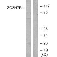 ZC3H7B Antibody