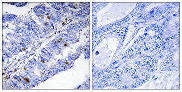 Phospho-NR4A1 (Ser351) Antibody