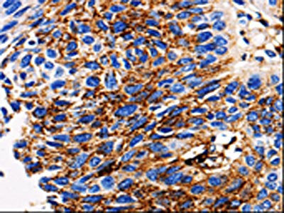 ADAMTS5 Antibody