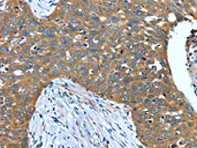 DTX1 Antibody