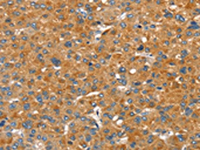 SLC29A4 Antibody