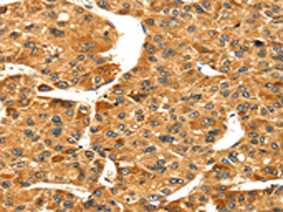 S100A14 Antibody