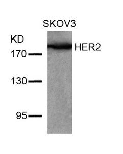 ERBB2 (Ab-877) Antibody