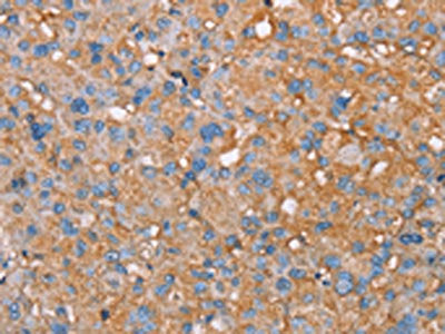 PAGE5 Antibody