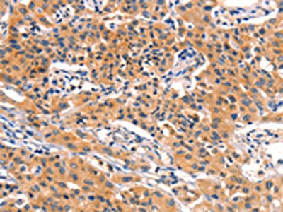 AMY2A Antibody