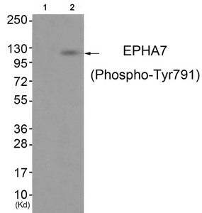 Phospho-EPHA7 (Tyr791) Antibody