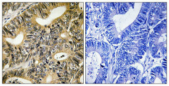 Phospho-EIF4EBP1 (Thr70) Antibody