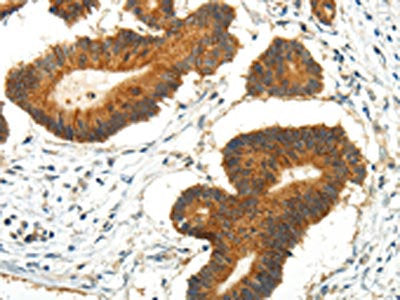 AQP3 Antibody