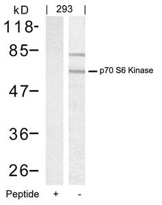 RPS6KB1 (Ab-389) Antibody