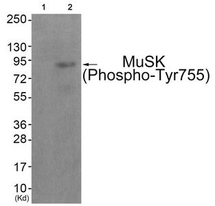 Phospho-MUSK (Tyr755) Antibody