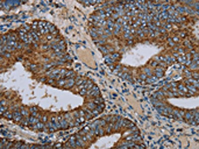 NDUFA9 Antibody