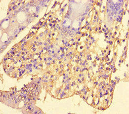 SRGAP2C Antibody