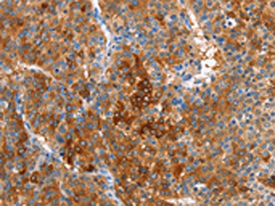CBS Antibody