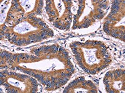KIR2DL3/KIR2DL1/KIR2DL4/KIR2DS4 Antibody