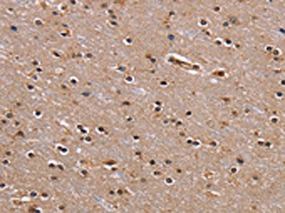 GNL3 Antibody